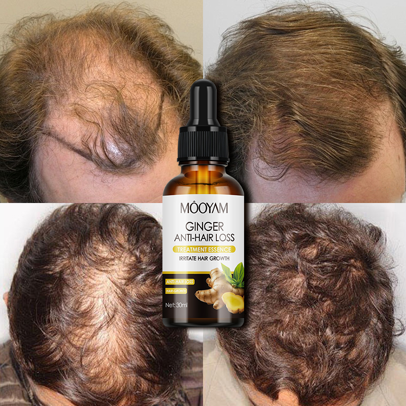 Hair Growth Serum